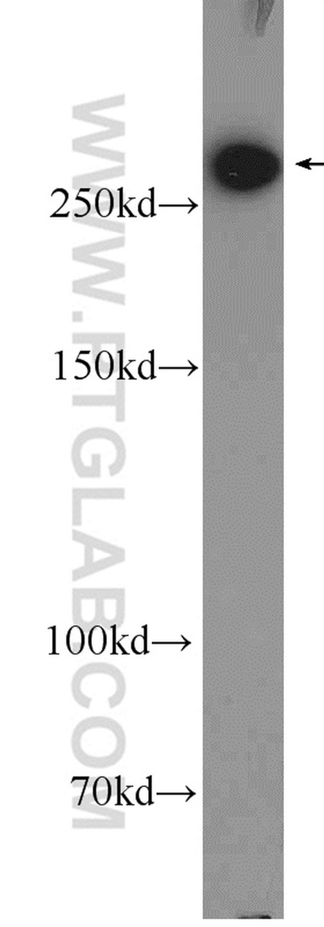 FASN Antibody in Western Blot (WB)