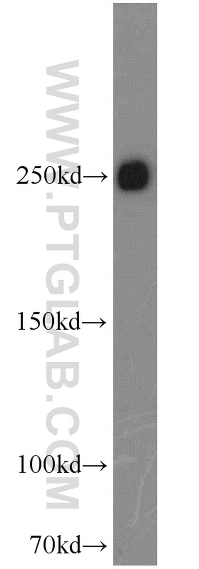 FASN Antibody in Western Blot (WB)