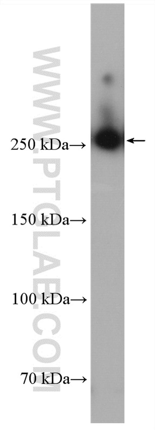 FASN Antibody in Western Blot (WB)