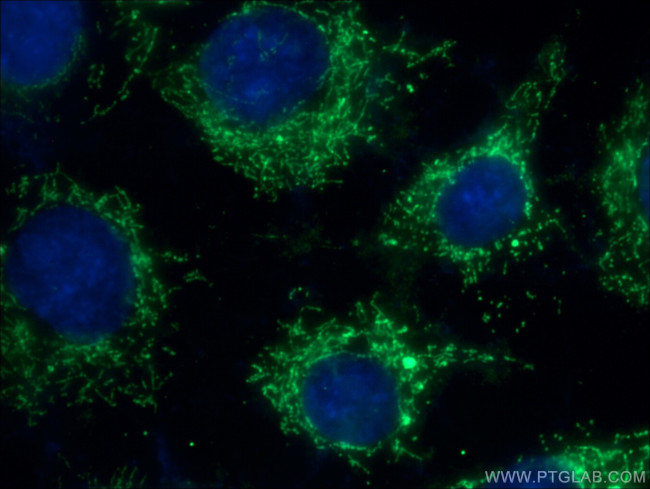 FADS1 Antibody in Immunocytochemistry (ICC/IF)