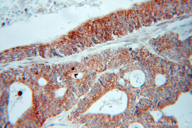 FADS1 Antibody in Immunohistochemistry (Paraffin) (IHC (P))