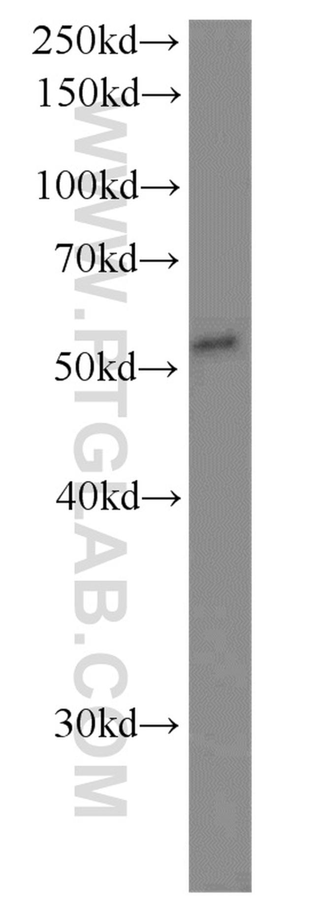 FADS1 Antibody in Western Blot (WB)