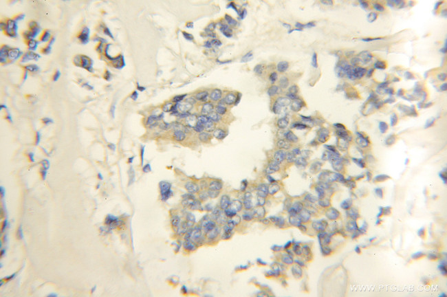 RNF34 Antibody in Immunohistochemistry (Paraffin) (IHC (P))