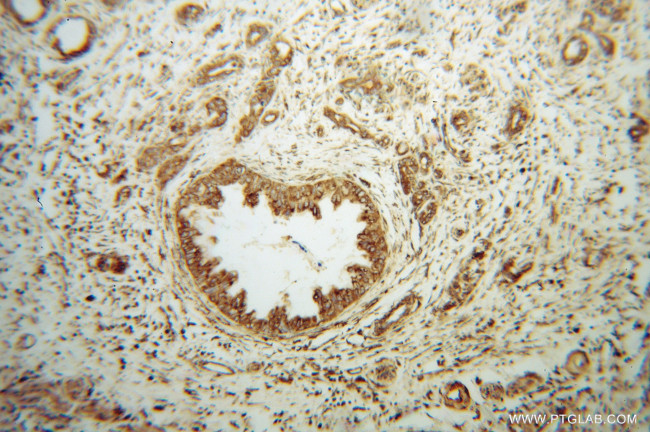 EEF1D Antibody in Immunohistochemistry (Paraffin) (IHC (P))