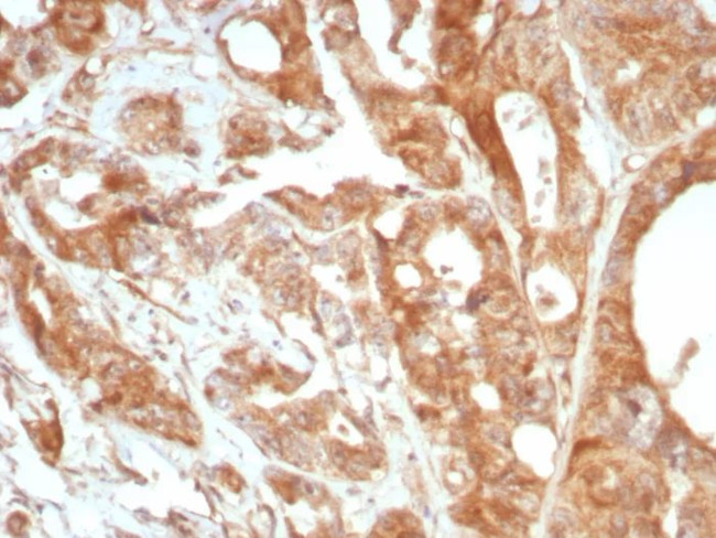 Podoplanin (PDPN) (Lymphatic Endothelial and Mesothelial Marker) Antibody in Immunohistochemistry (Paraffin) (IHC (P))