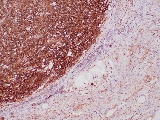 Podoplanin (PDPN) (Lymphatic Endothelial and Mesothelial Marker) Antibody in Immunohistochemistry (Paraffin) (IHC (P))