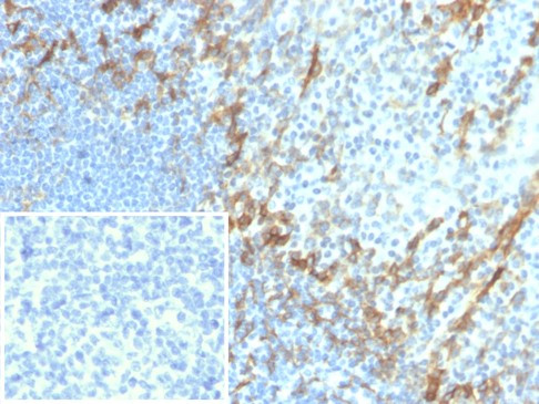 Podoplanin (PDPN) (Lymphatic Endothelial and Mesothelial Marker) Antibody in Immunohistochemistry (Paraffin) (IHC (P))