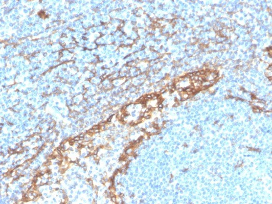 Podoplanin (PDPN) (Lymphatic Endothelial and Mesothelial Marker) Antibody in Immunohistochemistry (Paraffin) (IHC (P))