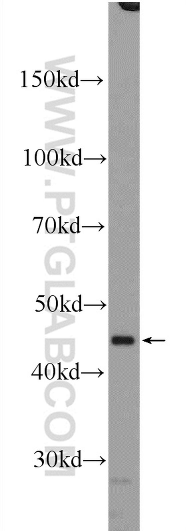 RXRA Antibody in Western Blot (WB)