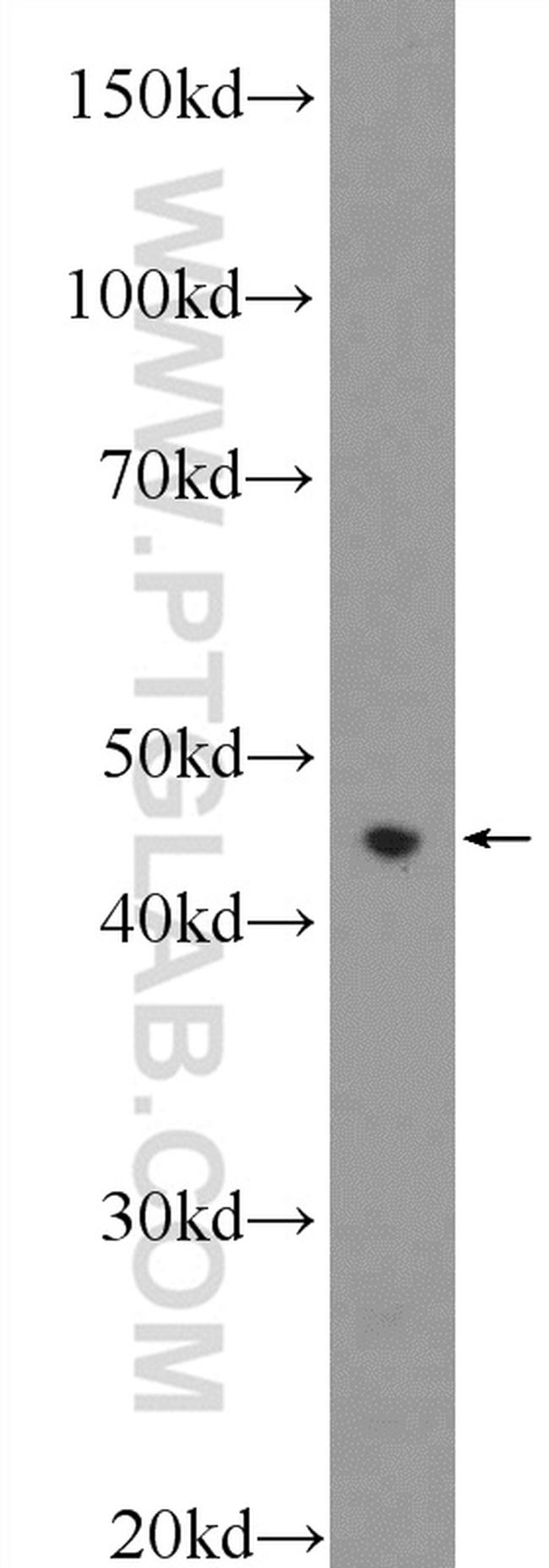 RXRA Antibody in Western Blot (WB)