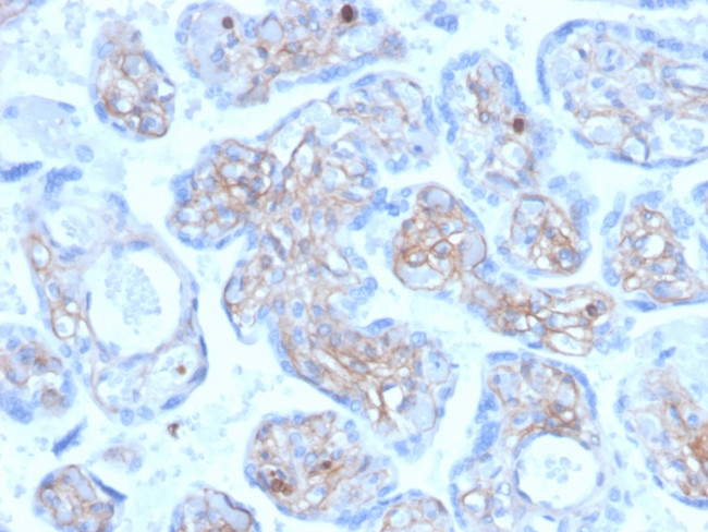 Periostin (POSTN) Antibody in Immunohistochemistry (Paraffin) (IHC (P))