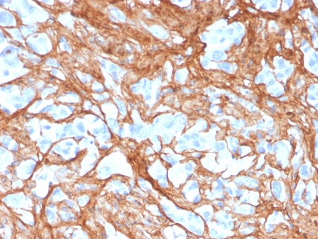 Periostin (POSTN) Antibody in Immunohistochemistry (Paraffin) (IHC (P))