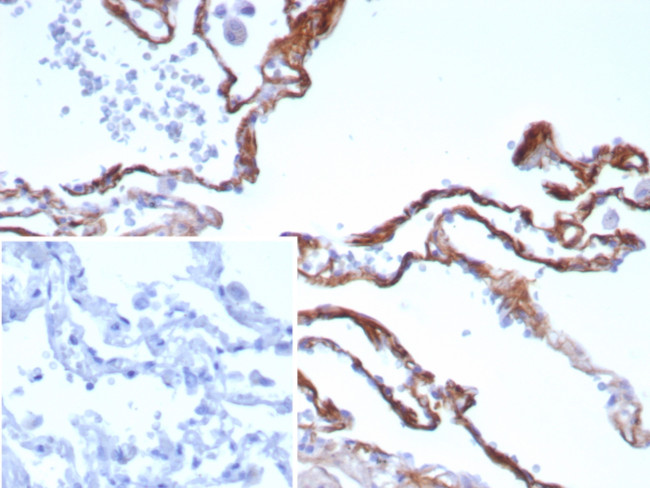 Periostin (POSTN) Antibody in Immunohistochemistry (Paraffin) (IHC (P))