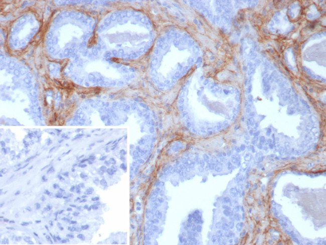 Periostin (POSTN) Antibody in Immunohistochemistry (Paraffin) (IHC (P))