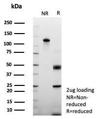 Periostin (POSTN) Antibody in SDS-PAGE (SDS-PAGE)