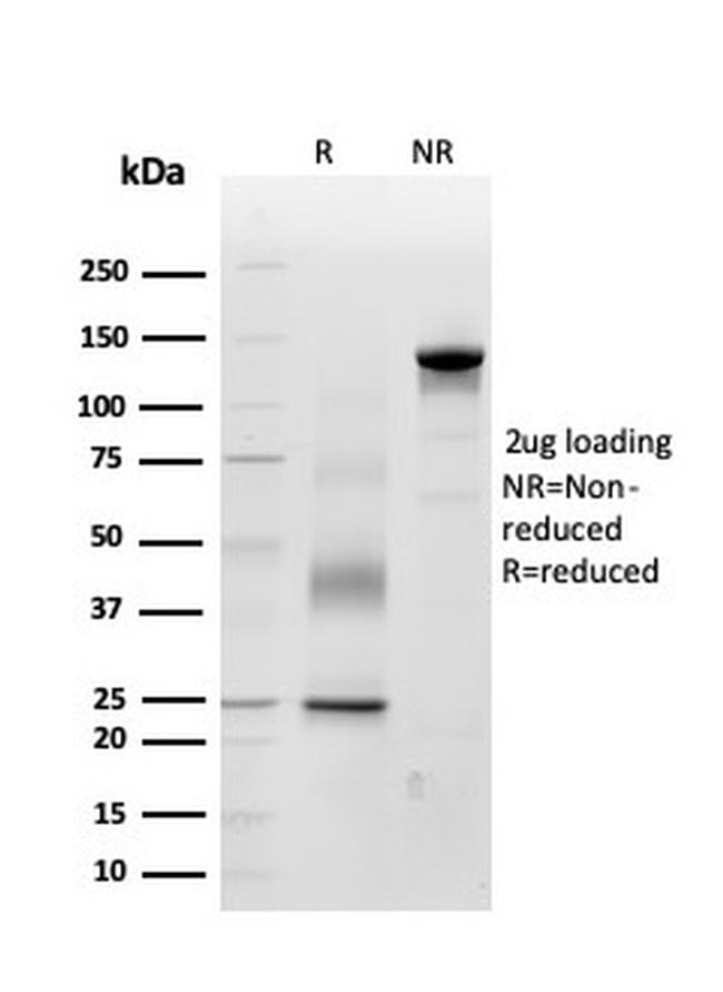 Periostin (POSTN) Antibody in SDS-PAGE (SDS-PAGE)