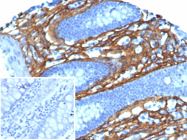 Periostin (POSTN) Antibody in Immunohistochemistry (Paraffin) (IHC (P))