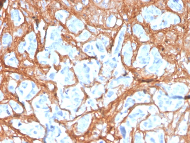 Periostin (POSTN) Antibody in Immunohistochemistry (Paraffin) (IHC (P))