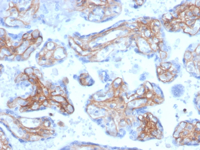 Periostin (POSTN) Antibody in Immunohistochemistry (Paraffin) (IHC (P))