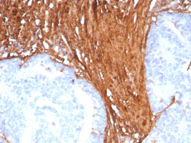 Periostin (POSTN) Antibody in Immunohistochemistry (Paraffin) (IHC (P))