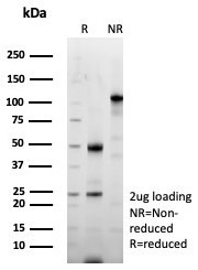 Periostin (POSTN) Antibody in SDS-PAGE (SDS-PAGE)