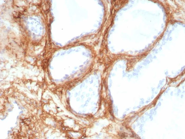 Periostin (POSTN) Antibody in Immunohistochemistry (Paraffin) (IHC (P))