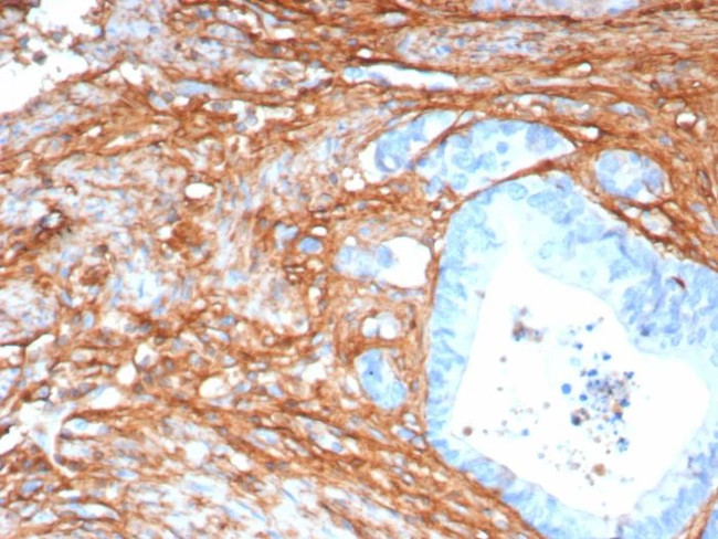 Periostin (POSTN) Antibody in Immunohistochemistry (Paraffin) (IHC (P))