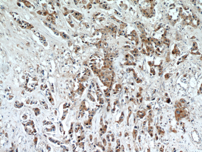 DLK1 Antibody in Immunohistochemistry (Paraffin) (IHC (P))