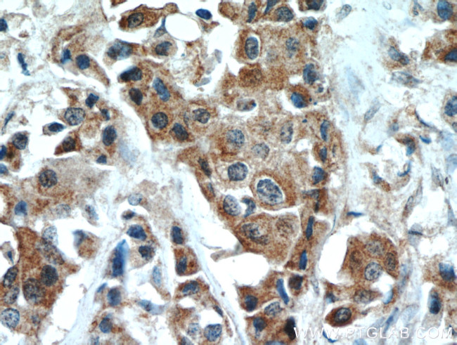 DLK1 Antibody in Immunohistochemistry (Paraffin) (IHC (P))