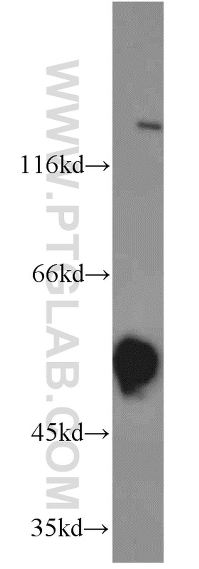 DLK1 Antibody in Western Blot (WB)