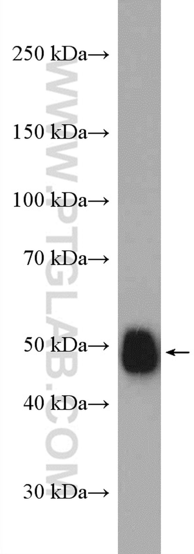 DLK1 Antibody in Western Blot (WB)