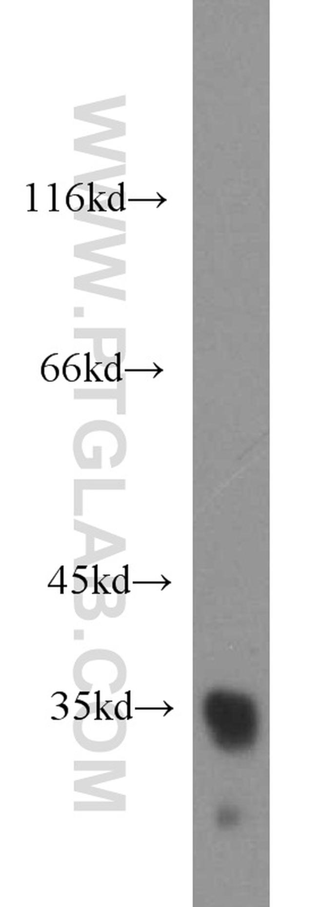 REDD1 Antibody in Western Blot (WB)