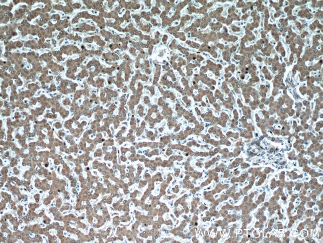 REDD1 Antibody in Immunohistochemistry (Paraffin) (IHC (P))