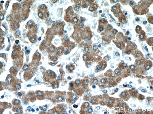 REDD1 Antibody in Immunohistochemistry (Paraffin) (IHC (P))