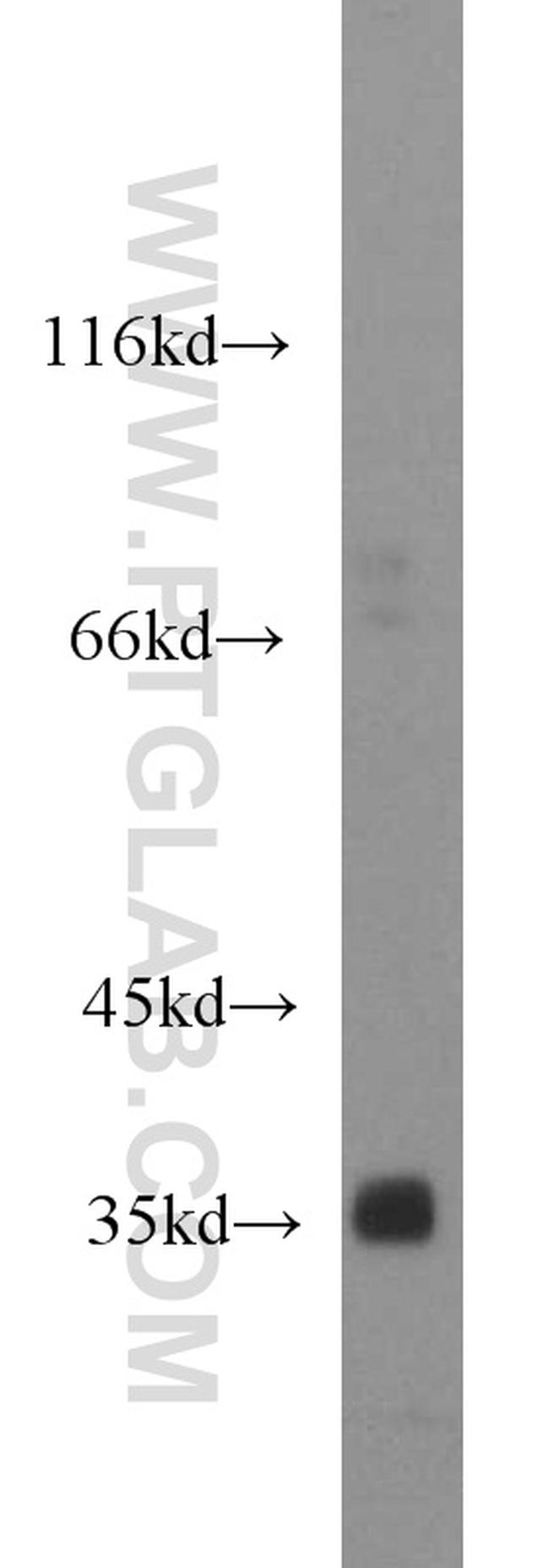 REDD1 Antibody in Western Blot (WB)