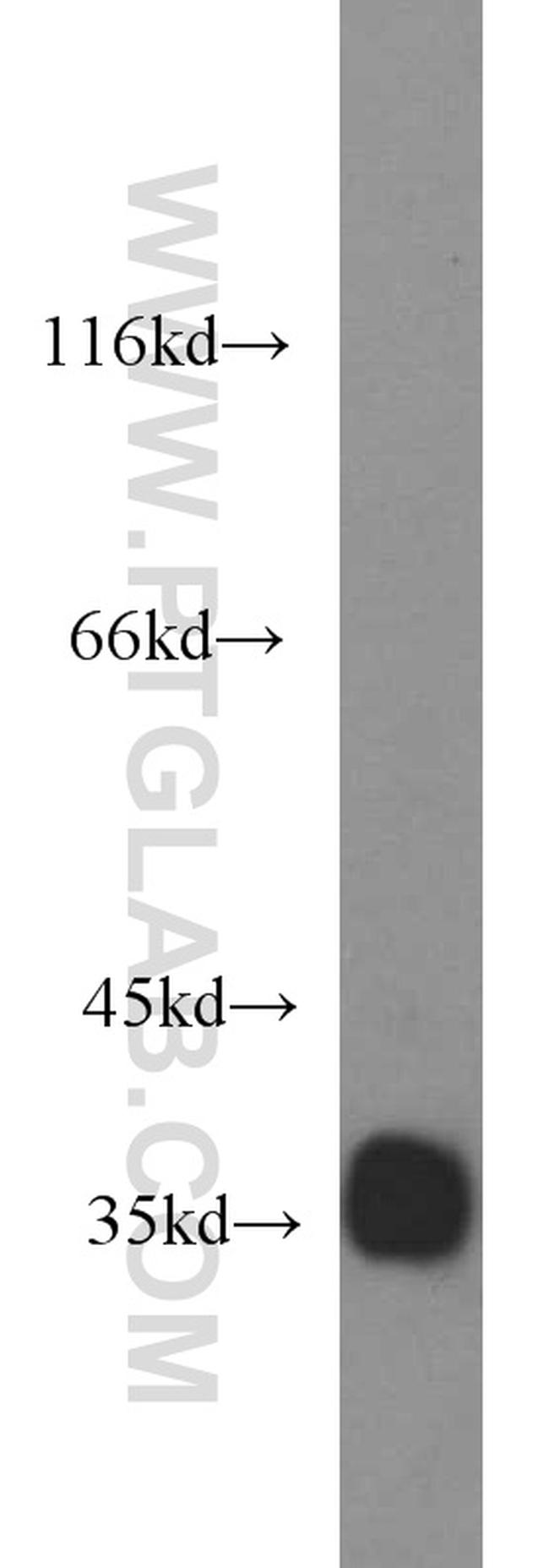 REDD1 Antibody in Western Blot (WB)