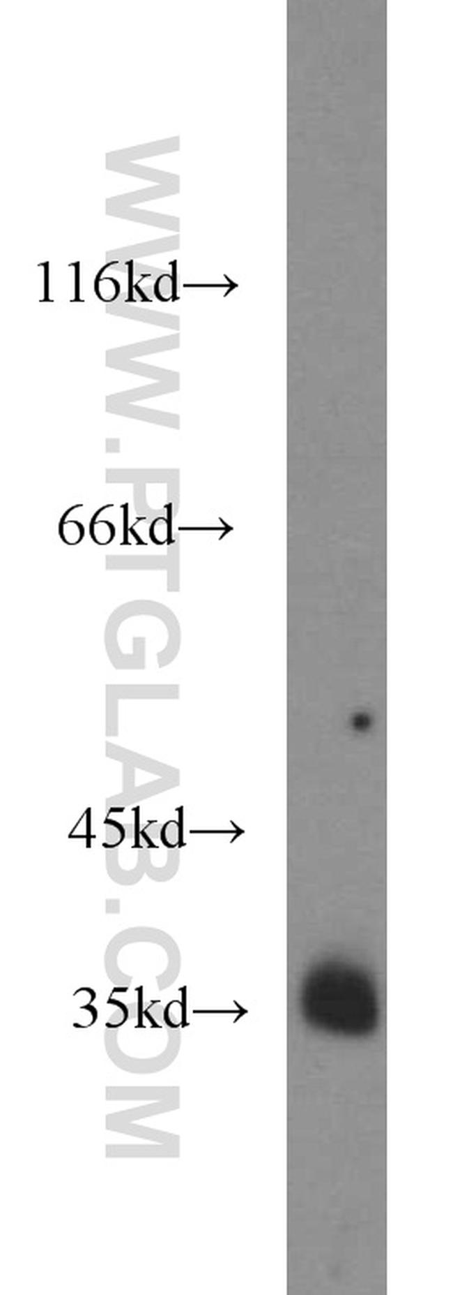 REDD1 Antibody in Western Blot (WB)