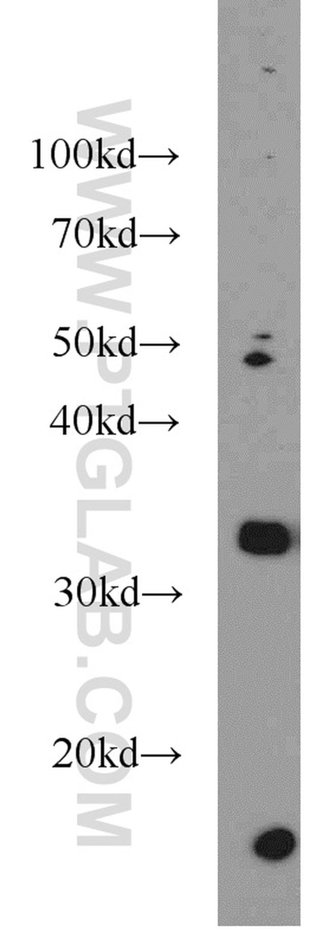 REDD1 Antibody in Western Blot (WB)