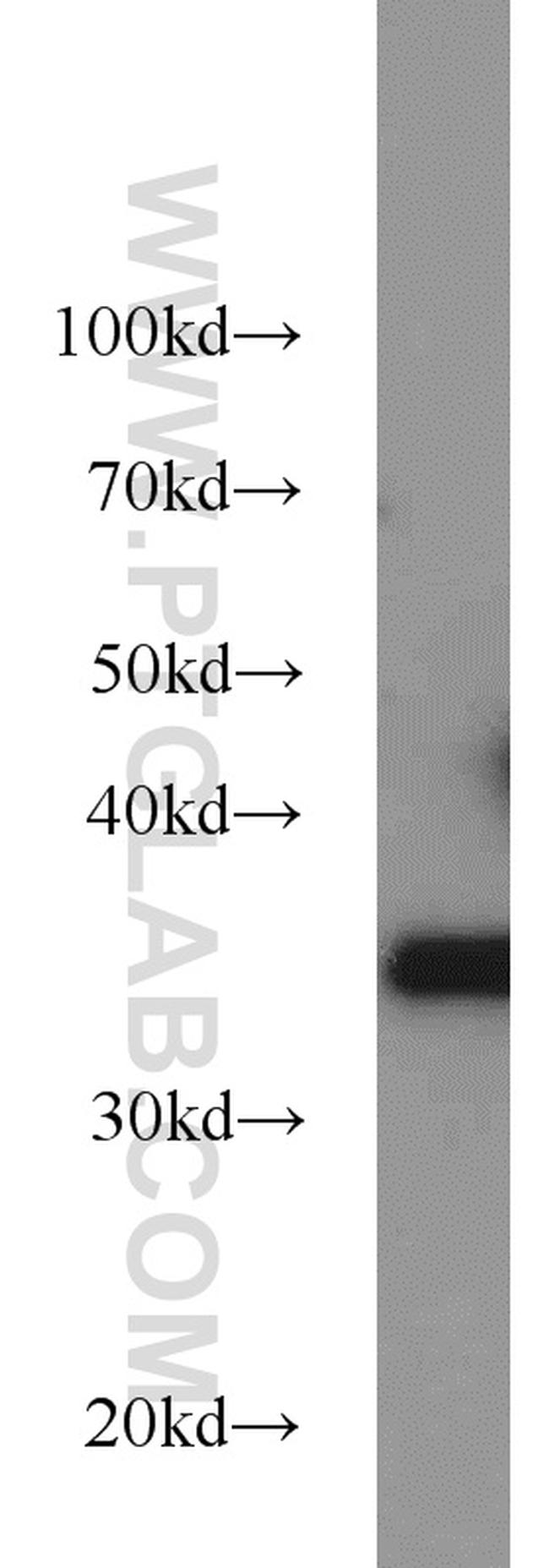 REDD1 Antibody in Western Blot (WB)