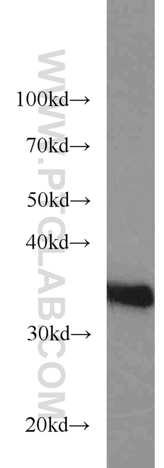 REDD1 Antibody in Western Blot (WB)