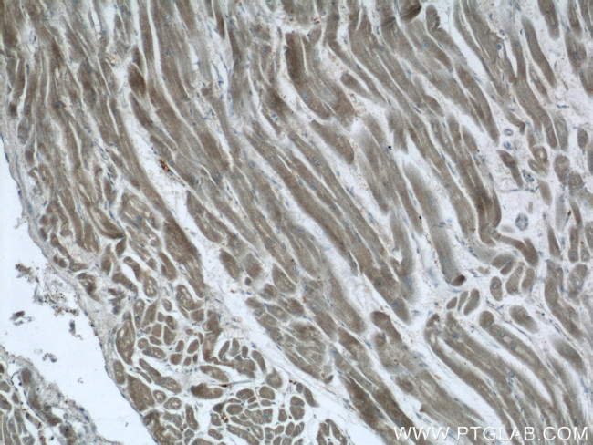 PACSIN3 Antibody in Immunohistochemistry (Paraffin) (IHC (P))