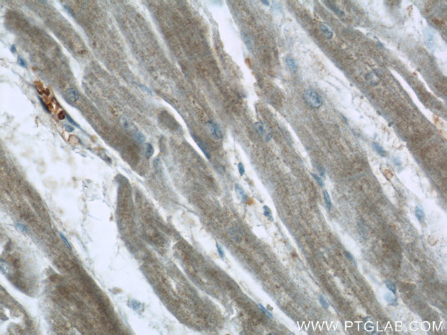 PACSIN3 Antibody in Immunohistochemistry (Paraffin) (IHC (P))