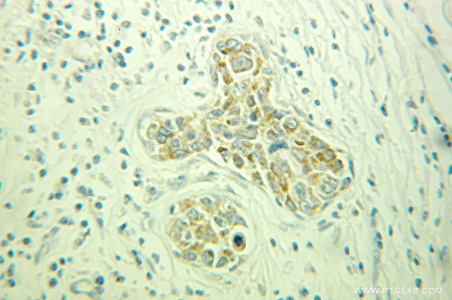 PACSIN3 Antibody in Immunohistochemistry (Paraffin) (IHC (P))