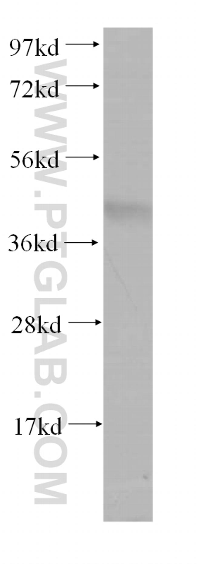 PACSIN3 Antibody in Western Blot (WB)