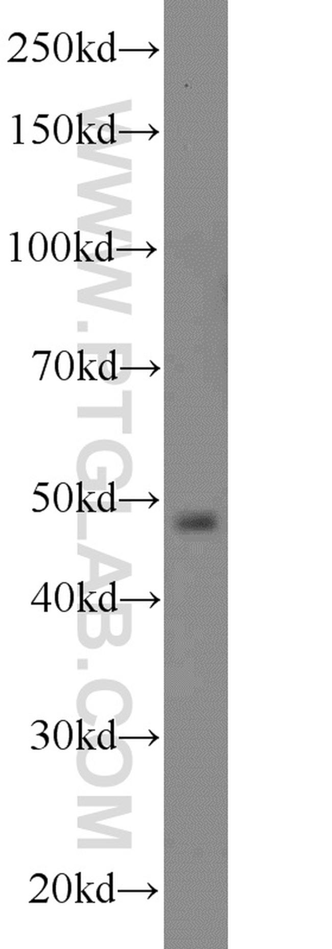 PACSIN3 Antibody in Western Blot (WB)