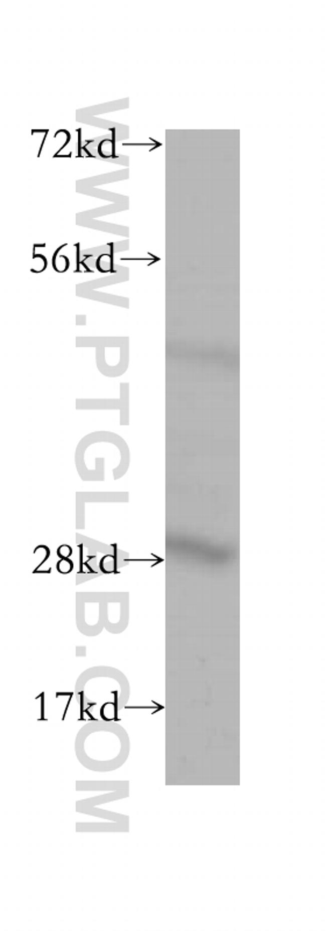 PACSIN3 Antibody in Western Blot (WB)