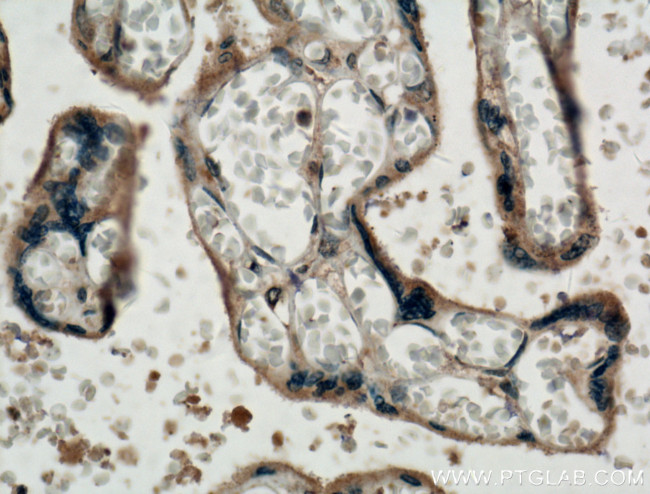 Placental Growth Factor Antibody in Immunohistochemistry (Paraffin) (IHC (P))