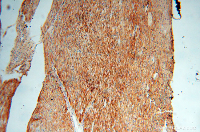 EMILIN1 Antibody in Immunohistochemistry (Paraffin) (IHC (P))