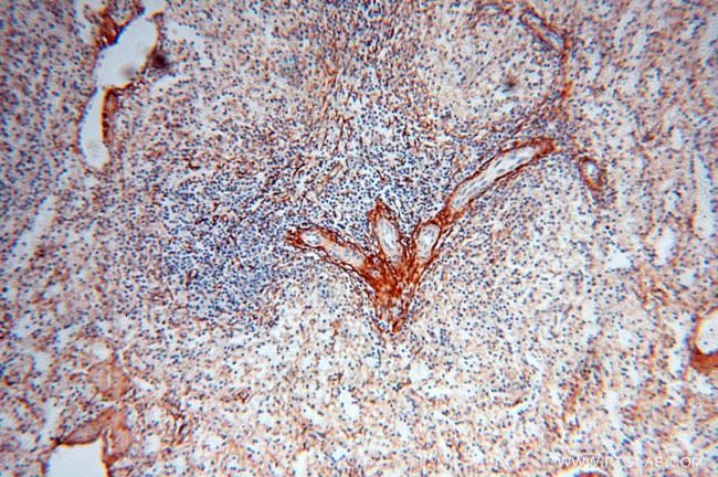 EMILIN1 Antibody in Immunohistochemistry (Paraffin) (IHC (P))