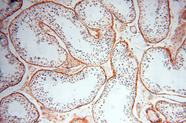 EMILIN1 Antibody in Immunohistochemistry (Paraffin) (IHC (P))